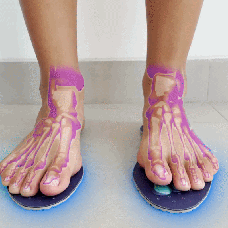 NeuroStep™ Magnetische Inlegzolen
