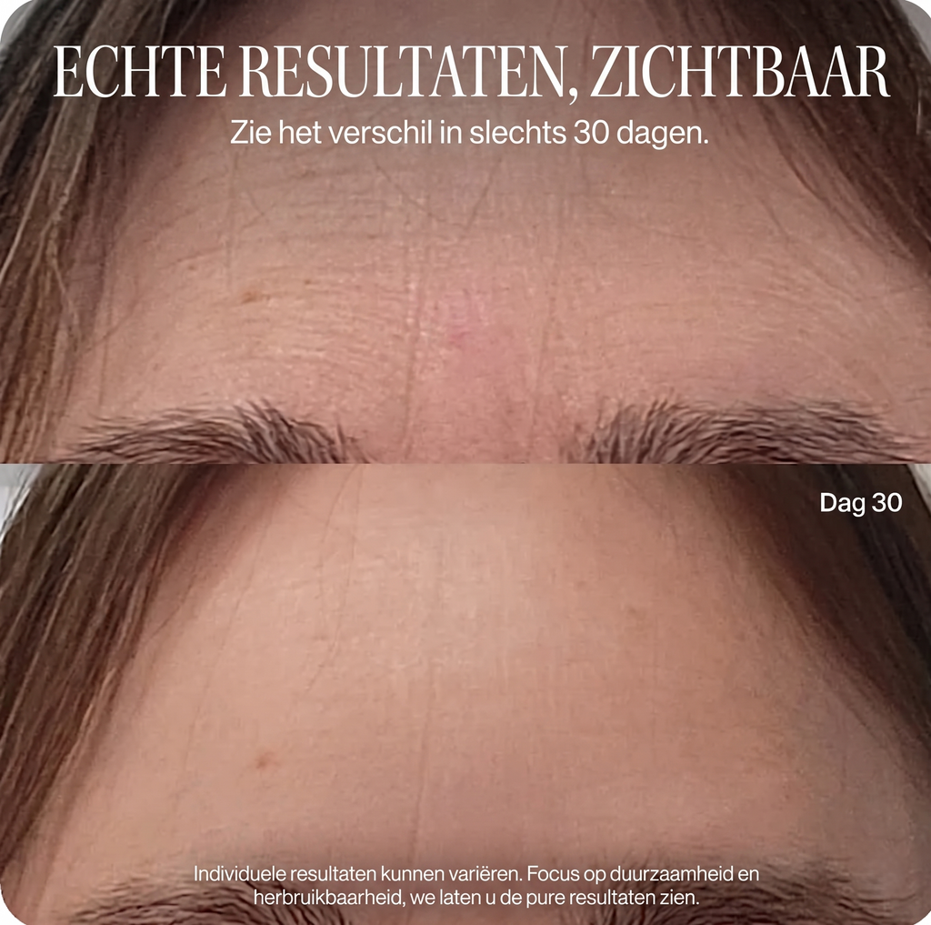 RevivePro LED Gezichtsversteviger Masker
